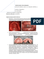 Impresiones Preliminares