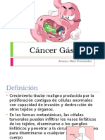 Cáncer Gástrico