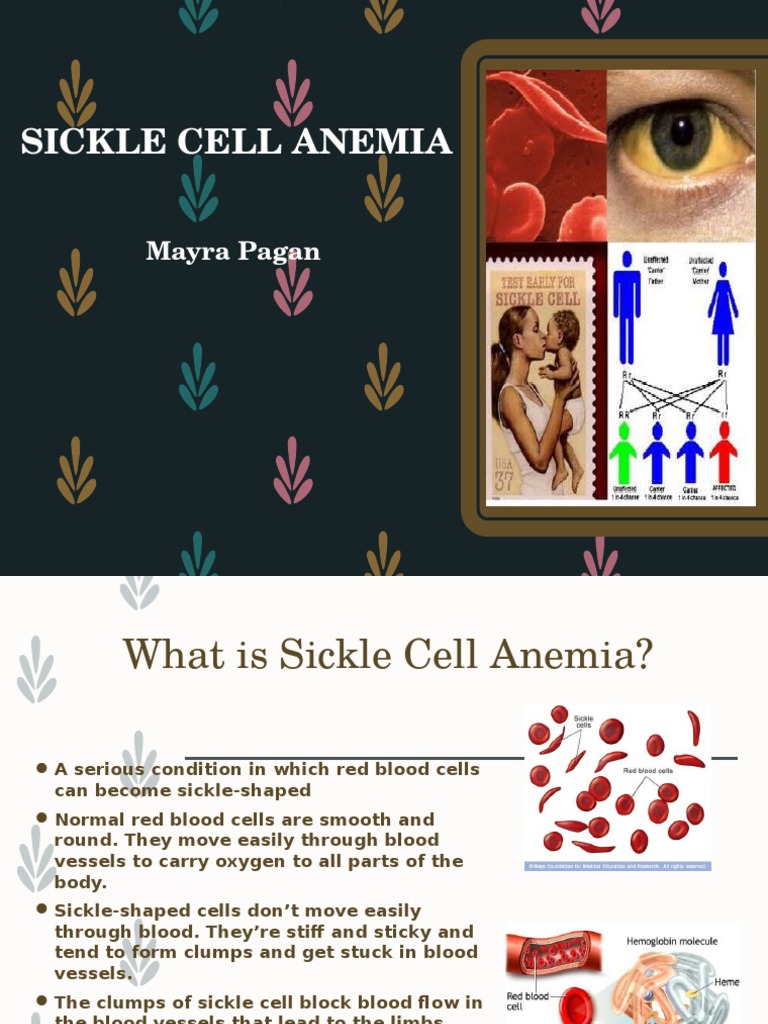 Sickle Cell Anemia | Sickle Cell Disease | Anemia | Free 30-day Trial ...