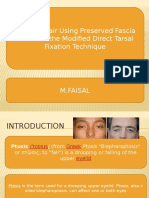 Ptosis Repair Using Preserved Fascia Lata With The Modified Direct Tarsal Fixation Technique