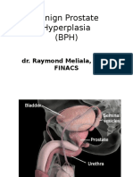 Benign Prostate Hyperplasia Reva