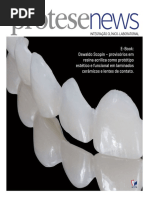 Provisorio Acrilico p Facetas