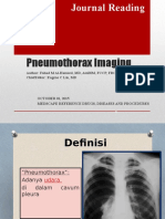 Pneumothorax Imaging