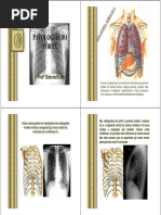 Patologias Do Tórax