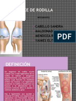 Esguince de Rodilla