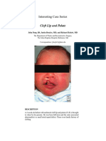 Cleft Lip and Palate 