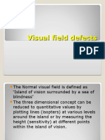 Visual field defects