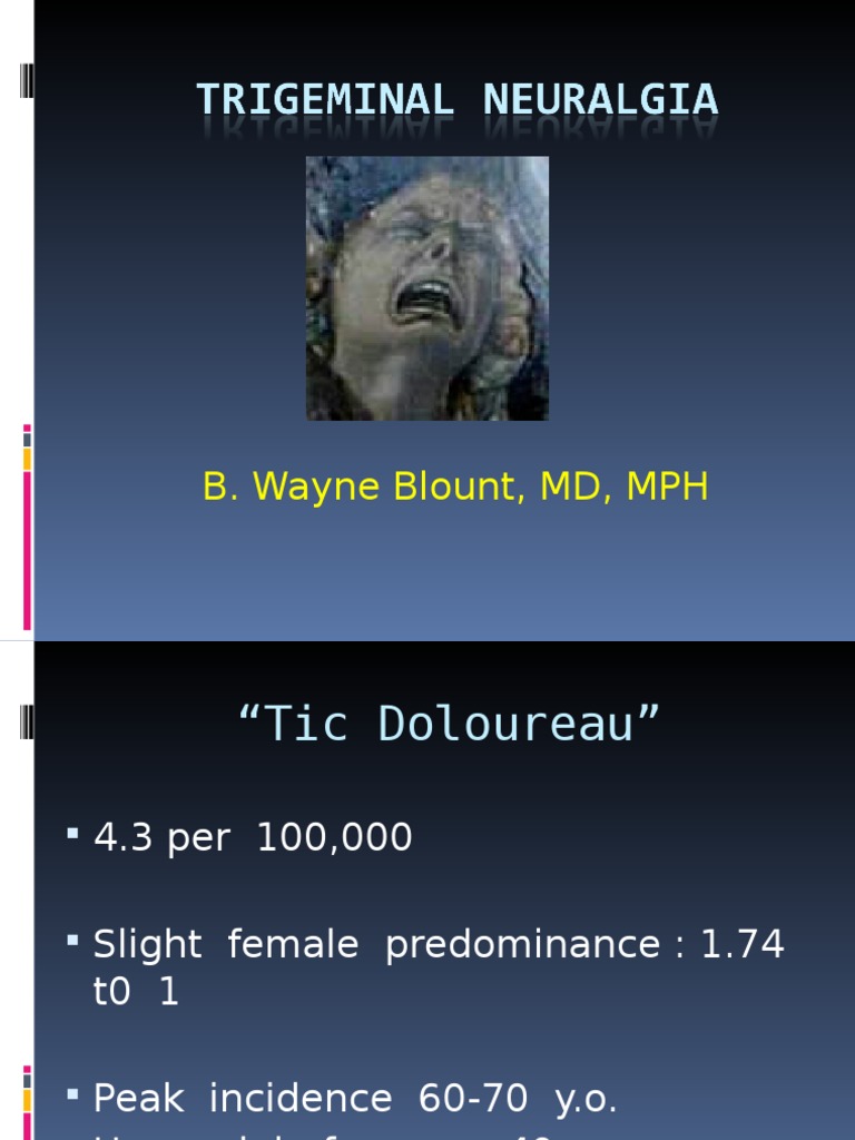 A Comprehensive Review of Trigeminal Neuralgia Including Epidemiology
