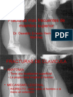 79532286-Fracturas-Mas-Frecuentes-de-Miembro-Superior.pptx