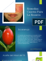 Remedios Caseros para La Rosacea