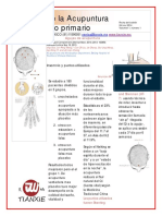 Eficacia de La Acupuntura en Insomnio Primario