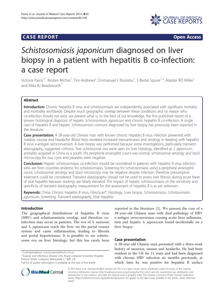 Schistosomiasis symptoms image