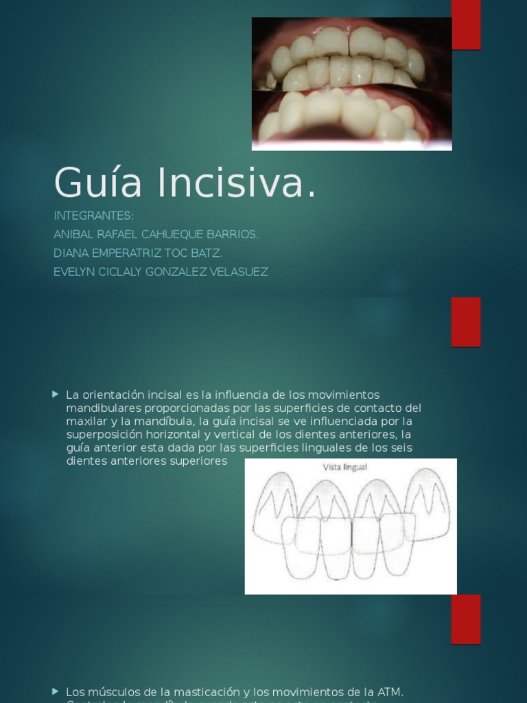 Guía Incisiva. Human Tooth Dentistry