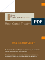 Root Canal Treatment