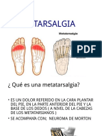 Metatarsal Gia