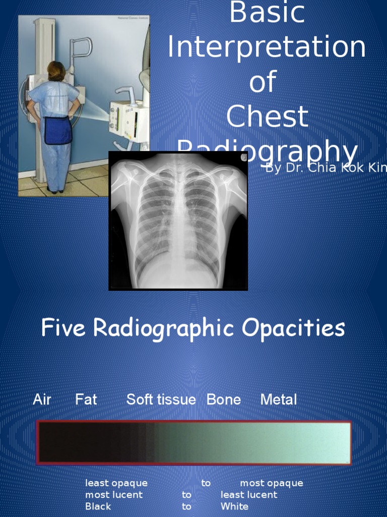 Chest Radiography Interpretation Guide | PDF | Lung | Thorax