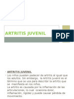 ARTRITIS JUVENIL
