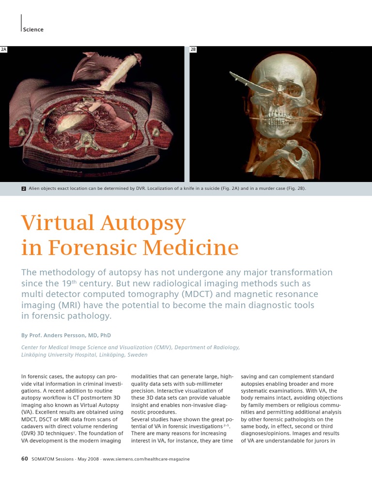 Virtual Autopsy in Forensic Medicine00085892 Medical Imaging Ct Scan