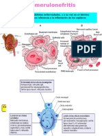 Glomerulonefritis 