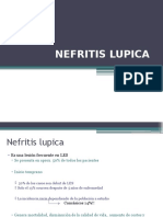 Nefritis Lupica