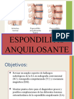 Espondilitis Anquilosante Imagenología