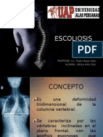 Escoliosis