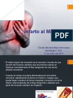 Infarto Miocardio Síntomas Causas