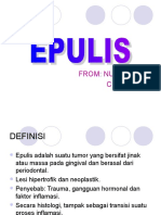EPULIS