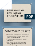 TUGAS PEMERIKSAAN PENUNJANG EFUSI PLEURA.pptx