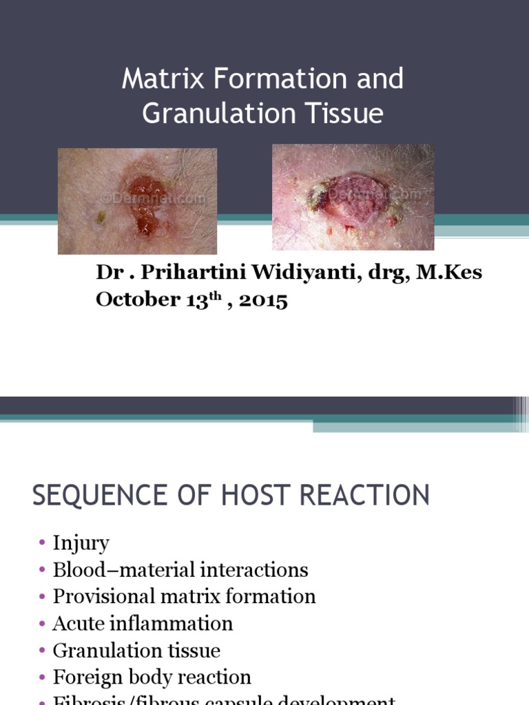 Granulation Tissue 13102015 Extracellular Matrix Healing