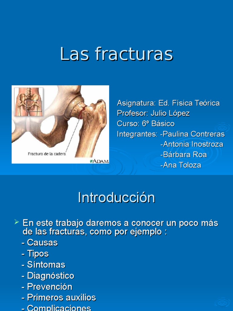 Guía Completa sobre Fracturas | PDF | Hueso | Osteoporosis