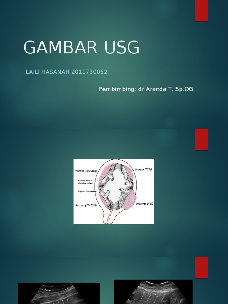 USG Imaging Findings in Pregnancy | PDF