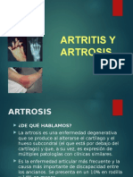 Causas, síntomas y tratamiento de la artrosis