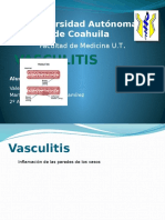Vasculitis medicina