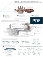 Infografía: Túnel Del Carpo y Dolor de Espalda