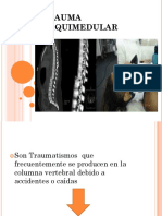 Trauma Raquimedular PDF