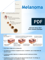 Melanoma