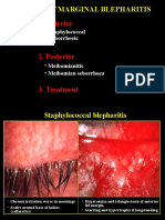 Anterior: Chronic Marginal Blepharitis