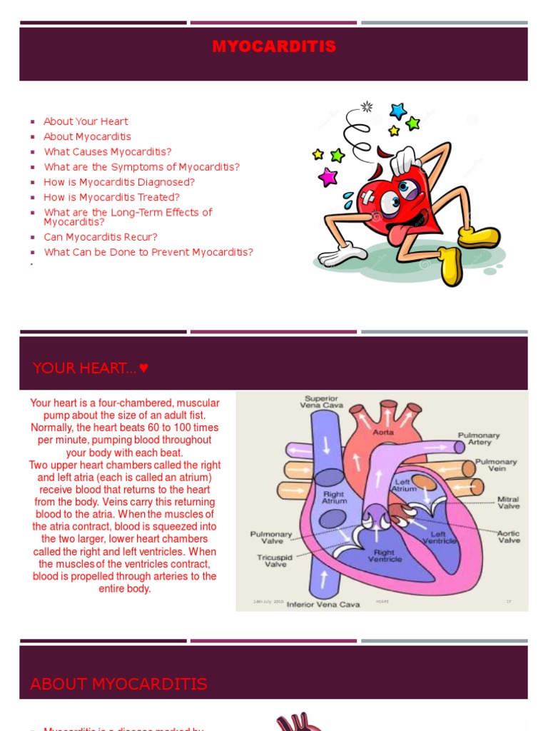 Myocarditis | Atrium (Heart) | Heart