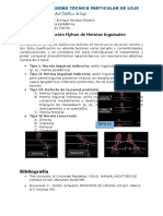 Clasificacion Hernias InguinalesNyhus