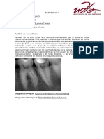 Endodoncia I