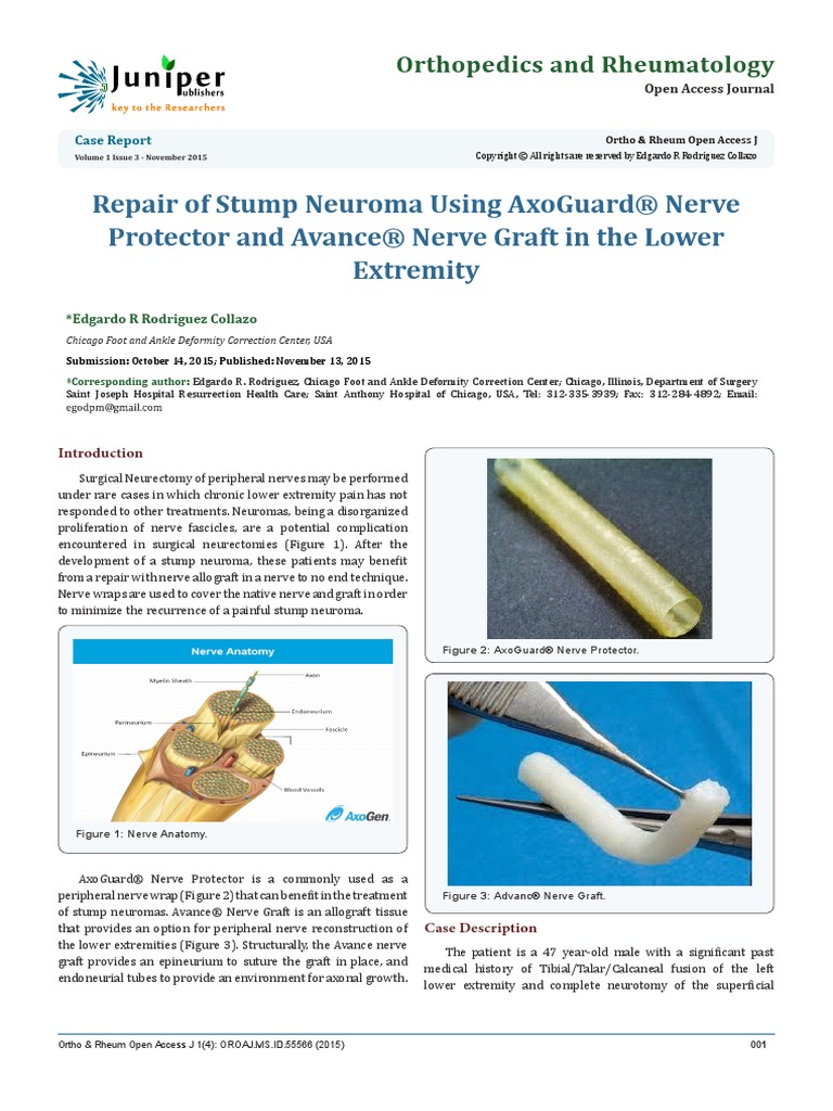 Repair of Stump Neuroma Using AxoGuard® Nerve Protector and Avance