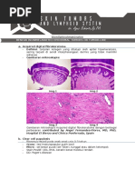 Download Dr Agus - Skin Tumor  Lymphoid System - Skin Tumors by Eky Nur Rahman SN314539707 doc pdf