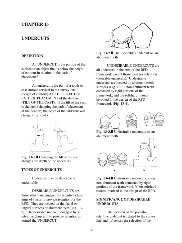 Undercuts Dentures Mouth