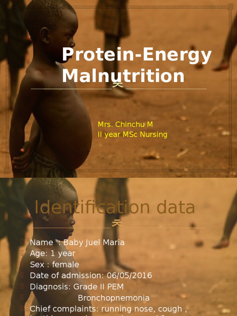 pem-ppt-malnutrition-nutrition