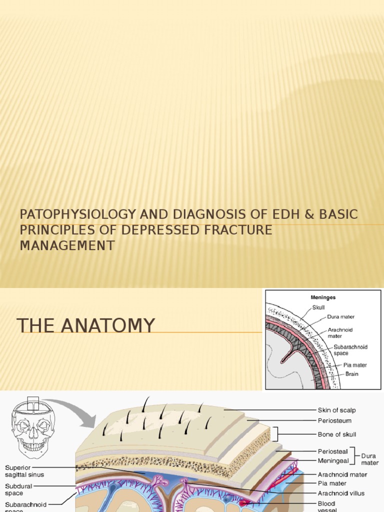 Patophysiology and Diagnosis of EDH & Basic Principles | PDF | Medical ...