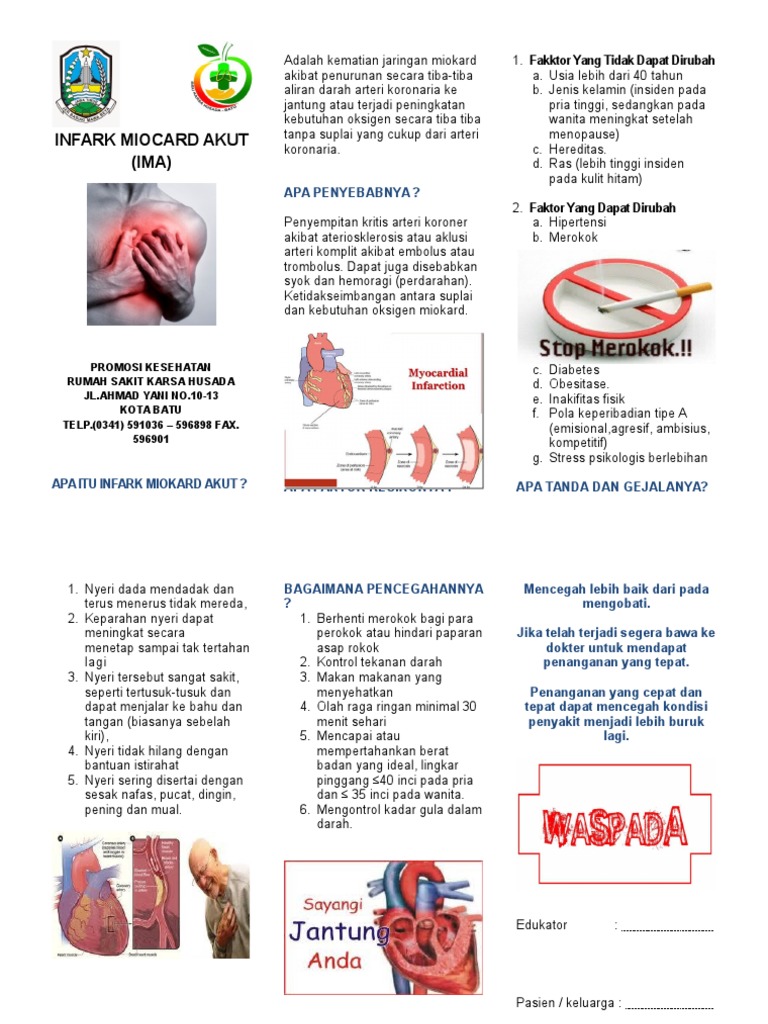 Infark Miocard Akut | PDF