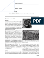 2009-RM Dos Tumores Uterinos - Cópia PDF