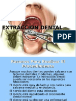 Extraccion Dental