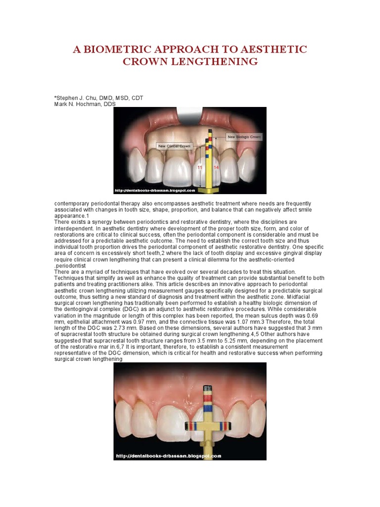 A Biometric Approach to Aesthetic Crown Lengthening Mouth Dentistry